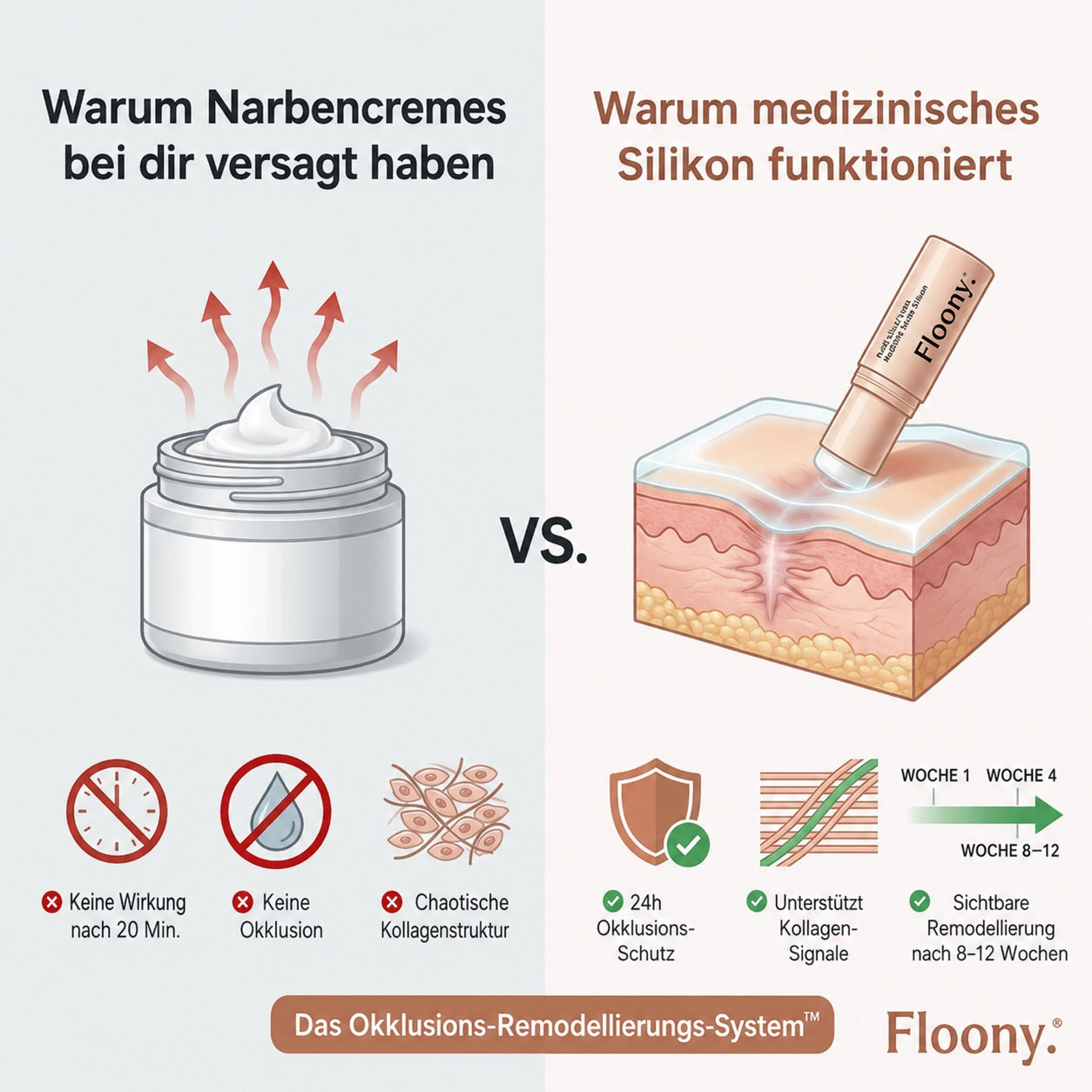 Vorher und nachher: Verbesserung von Aknenarben mit Floony